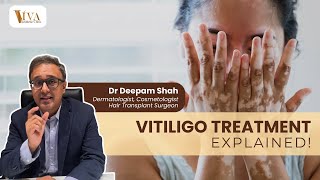 Vitiligo Explained: Causes, Prevention & Treatment | Is Vitiligo Contagious?