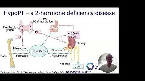 HPF 2025: FRE - Session 2: Revised ESE Guidelines on Hypoparathyroidism & Open Q&A