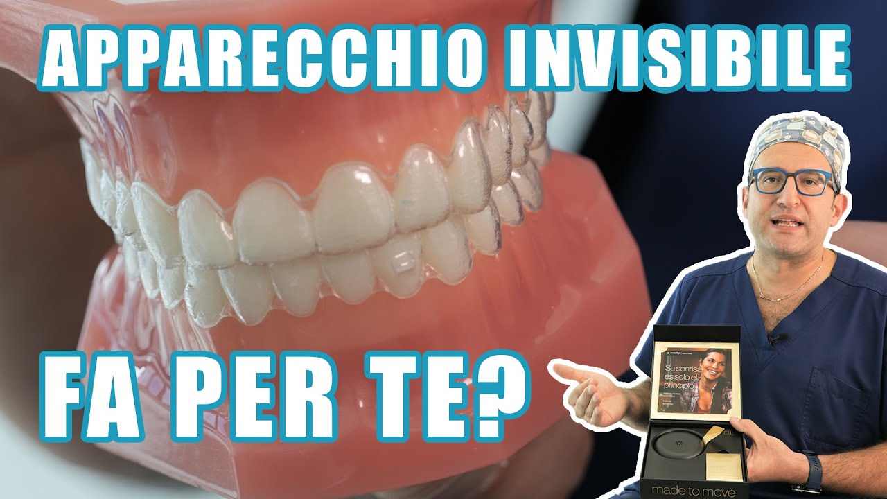 Allineatori Trasparenti (Apparecchio Invisibile) Tutto dalla prima visita al termine del lavoro