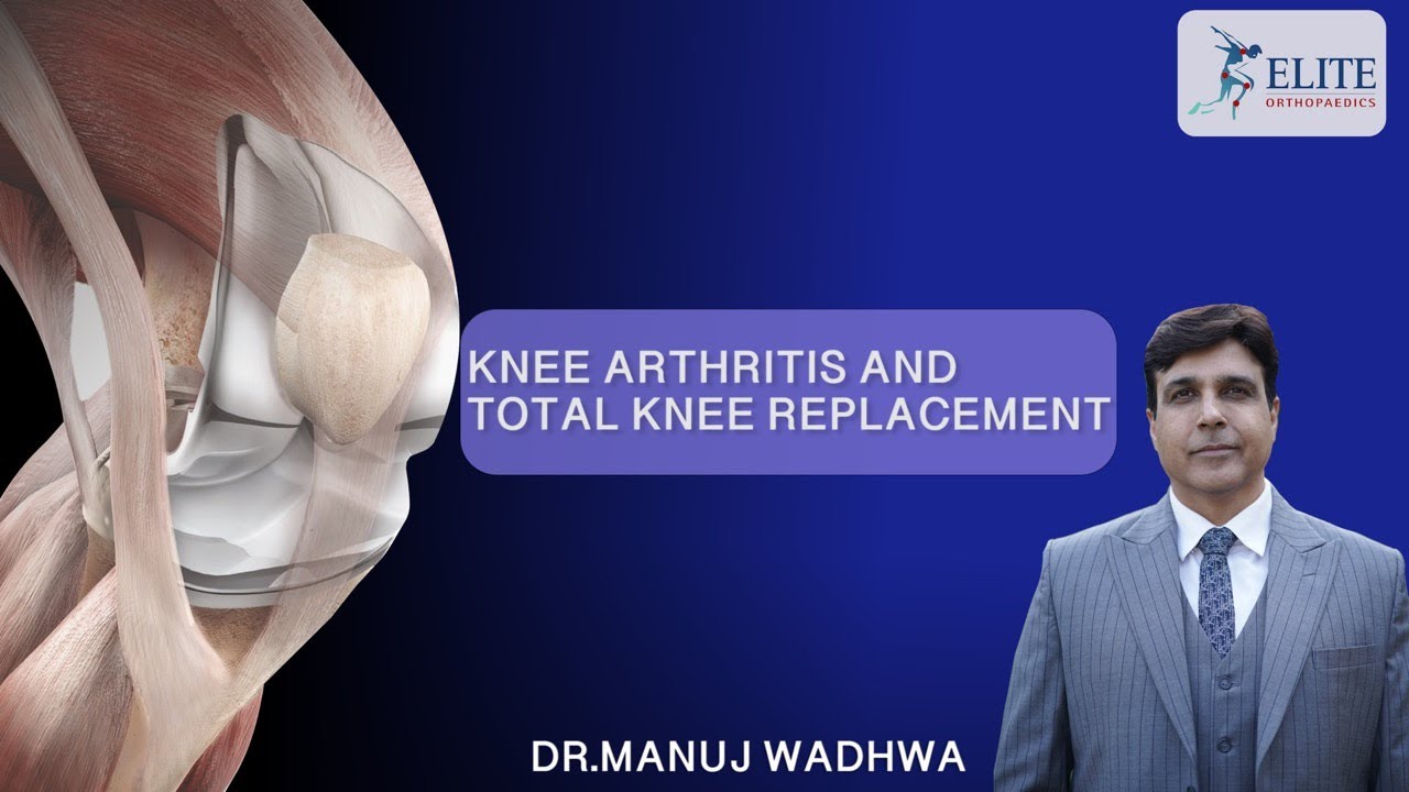 Knee Arthritis and Total Knee Replacement - Dr. Manuj Wadhwa | Best Orthopedic in Chandigarh