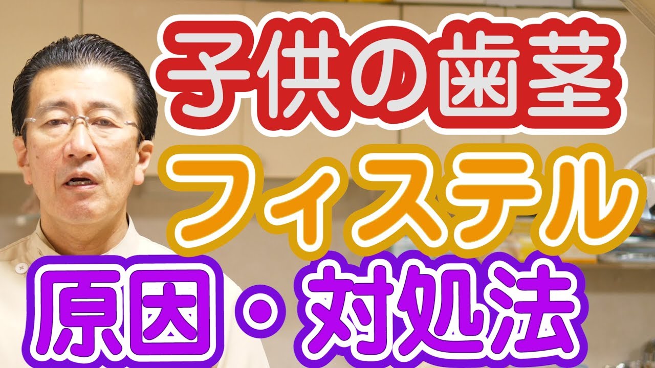 子供の歯茎がフィステルで腫れる原因と対処方法とは 神奈川県横浜市西区の歯医者フィルミーデンタルクリニックホワイトエッセンス Youtube 子供の歯茎がフィステルで腫れる原因と対処方法とは 神奈川県横浜市西区の歯医者フィルミーデンタルクリニックホワイトエッセンス Youtube