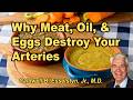 Why meat, oil, and eggs destroy your arteries with Caldwell B. Esselstyn, Jr., M.D.