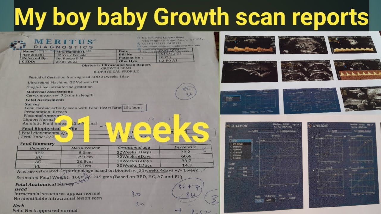 My Boy Baby 7 Month Growth Scan Reports 31 Weeks Growth Scan Reports My Boy Baby 7 Month Growth Scan Reports 31 Weeks Growth Scan Reports