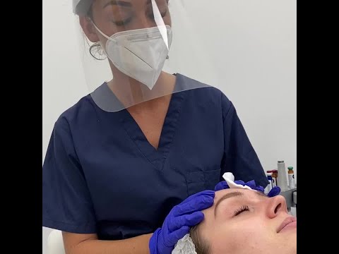 Mandelic Chemical Peel | Know About This Amazing Treatment | Elite Aesthetics