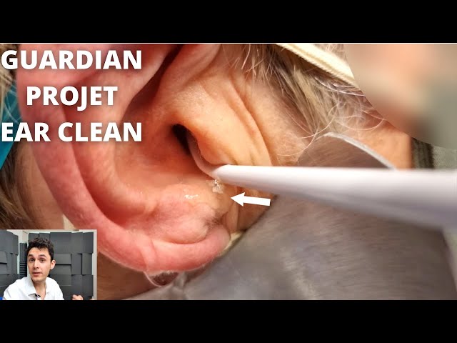 GUARDIAN PROJET Ear Irrigation (Ear Wax Removal) 