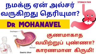 அல்சரை ஏற்படுத்துவது கிருமியா? Stomach Ulcer causes, Symptoms & Diagnosis -Tamil-Dr MOHANAVEL