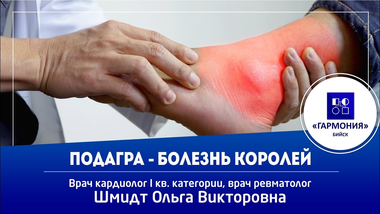 ПОДАГРА - БОЛЕЗНЬ ГЕНИЕВ И КОРОЛЕЙ - YouTube