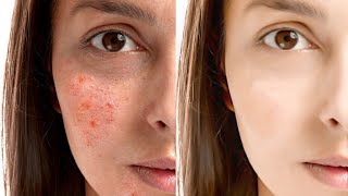 Remove Skin Blemish || Face Retouching | Pimple Remove In PicsArt | In 2 Mint || Smooth Skin Editing screenshot 4