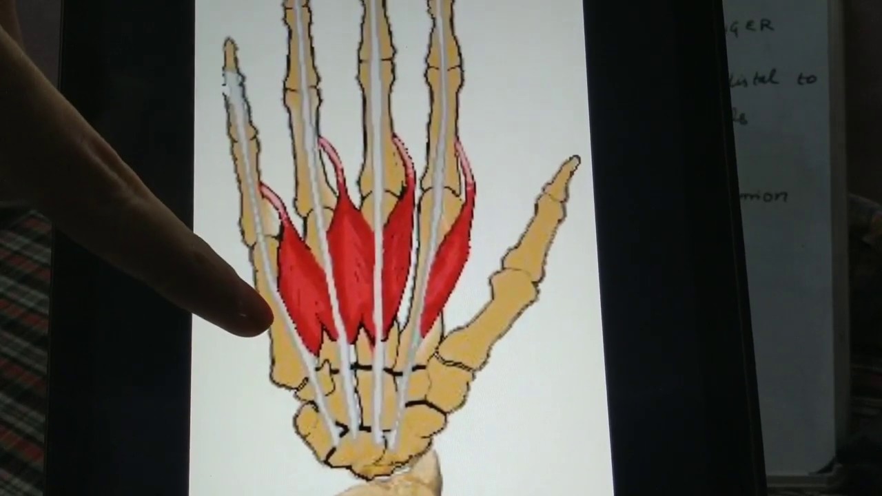 Deformities of hand