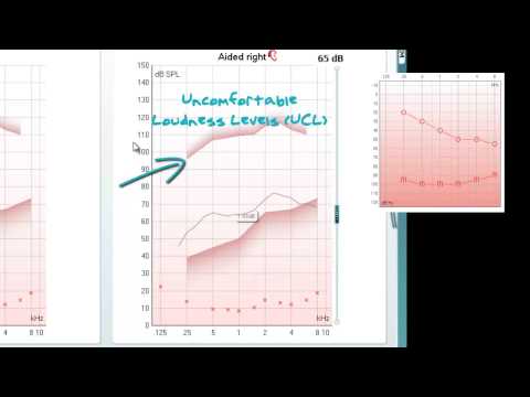 REM - VSPM display screen part 1