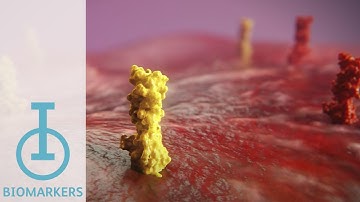 IOU Youtube: IO biomarkers under investigation for their role in immunotherapy