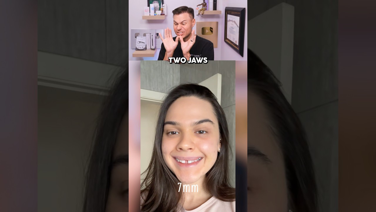 Real Reason Why Her Tooth Gap Is EXPANDING! 😳🦷