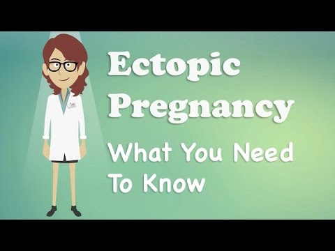 वीडियो: एक्टोपिक गर्भावस्था कैसे बताएं