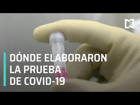 Cómo se hace la prueba de flujometría