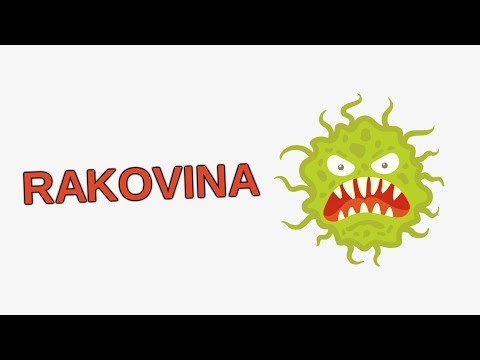 Video: Aká Je Prognóza Pre Rakovinu Prsníka 3. Stupňa?