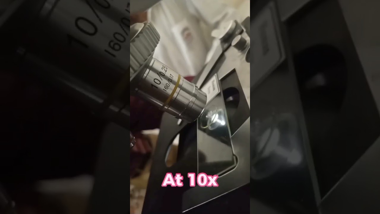 Bone Under Microscope🔬