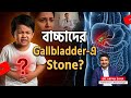 বাচ্চাদেরও Gallbladder stone হতে পারে? Gallbladder stone in children | Dr Arpan Saha
