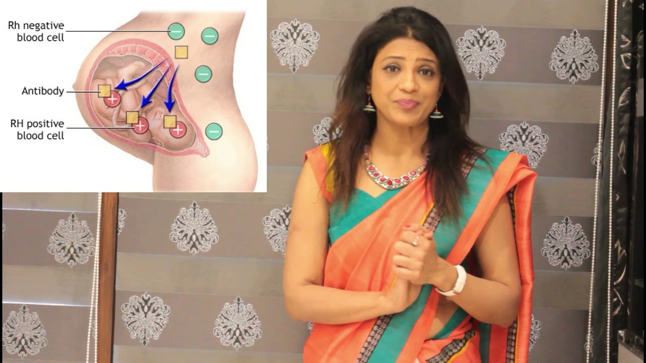 What happens if mother has negative blood group , what happens to such babies