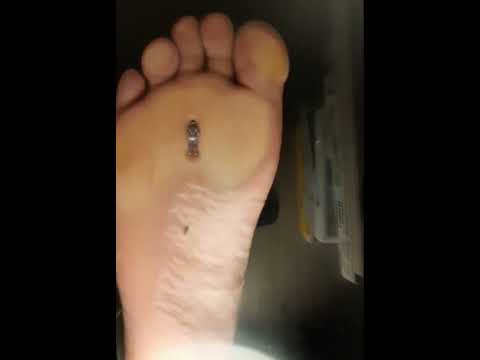 Sweaty Barefoot Underglass