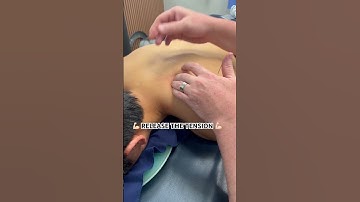 Release muscle tension with dry needling #chiro #chiropratic