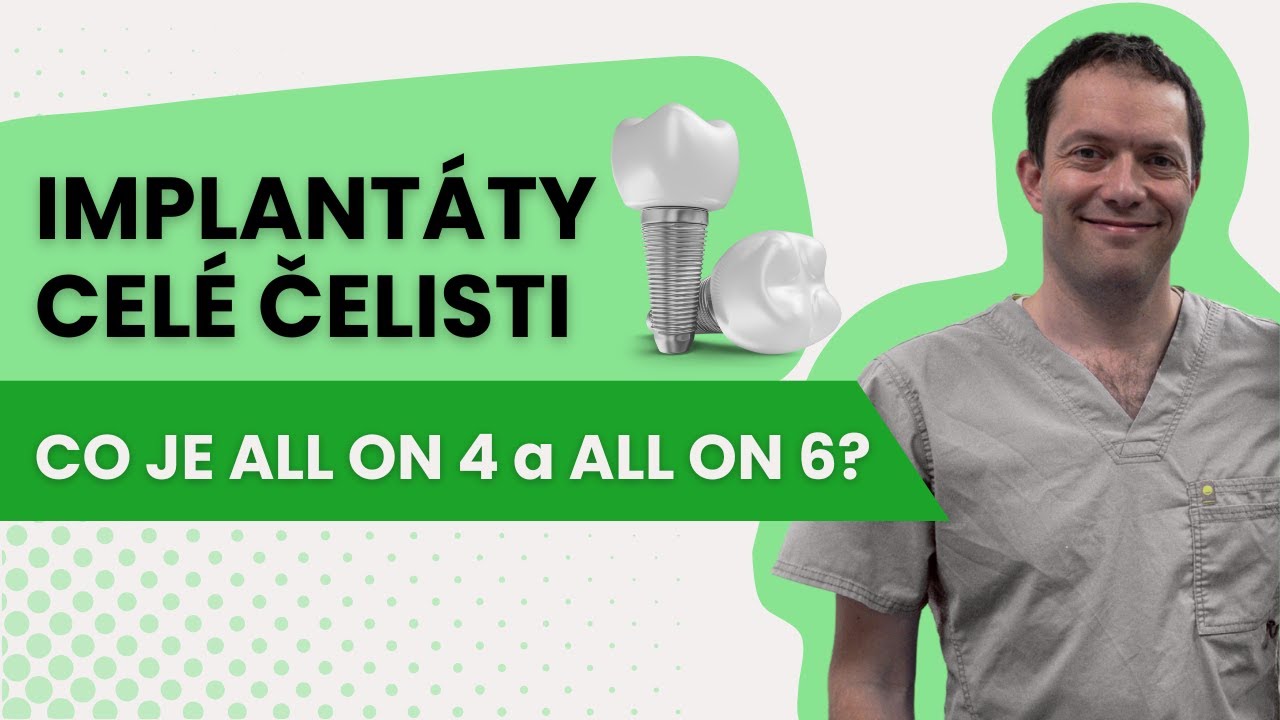 Implantáty celé čelisti | Co je All on 4 a All on 6? | MUDr. Pavel Vachulka