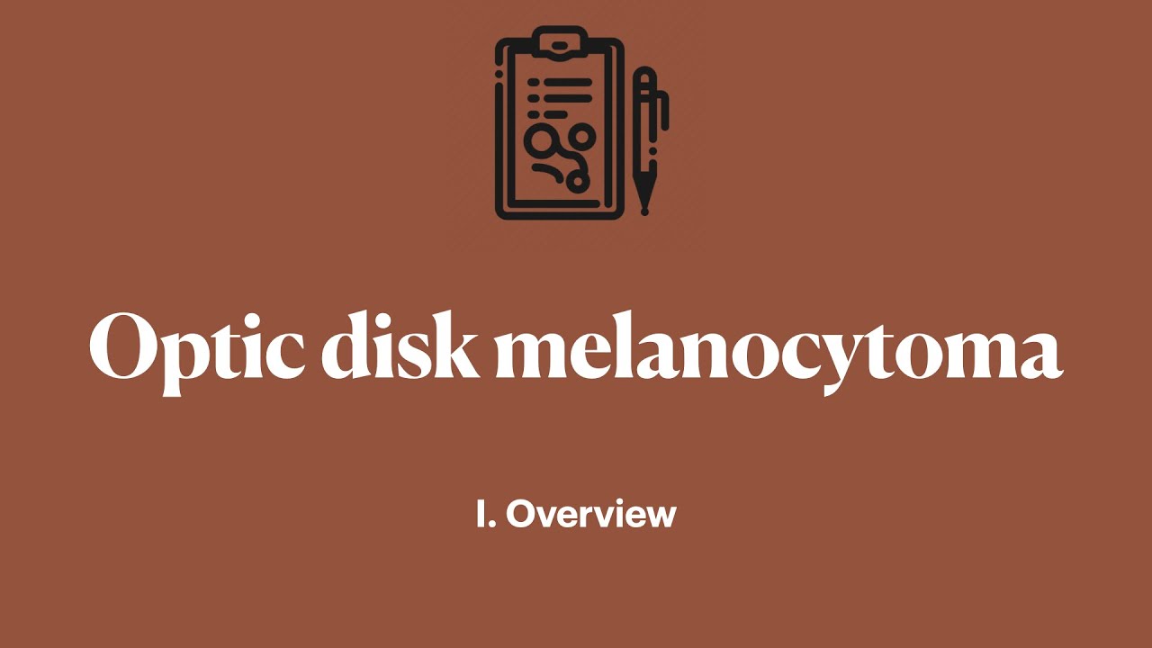 Optic disk melanocytoma. I. Overview YouTube