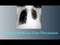 Internal Medicine Case Discussion || Pleural Effusion