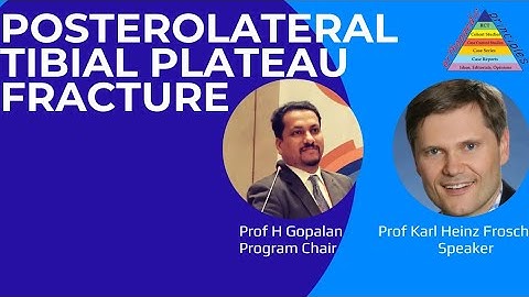 Posterolateral Tibial Plateau Fractures: Karl Frosch MD