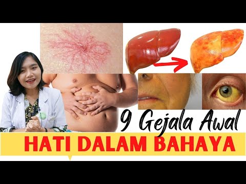 Video: Apakah perlemakan hati itu menyakitkan?