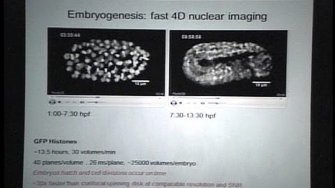 Dr. Hari Shroff: New Technologies for High Spatial and Temporal Resolution Imaging