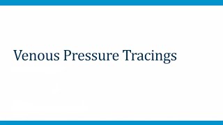 CVS 1.8 Venous Pressure Tracings (2025)