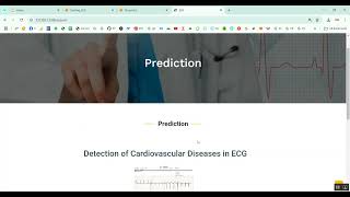 Cardiovascular Diseases in ECG Images in Python Projects