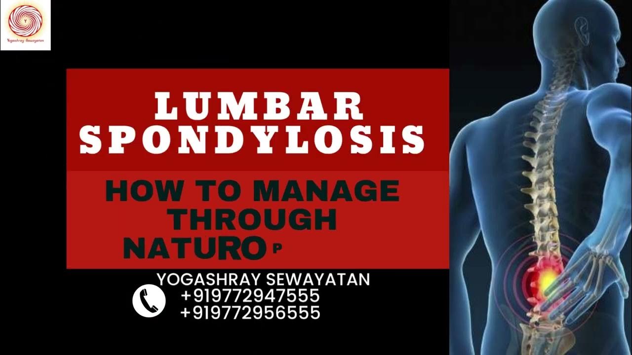 Lumbar Spondylosis Treatment through Naturopathy Yogashray Sewayatan