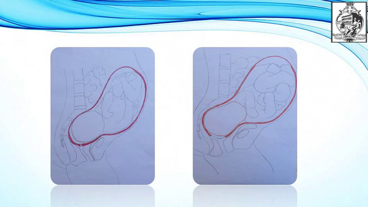 L'utilità dei movimenti pelvici attivi durante il travaglio - Physiotutors, image size:1280x720