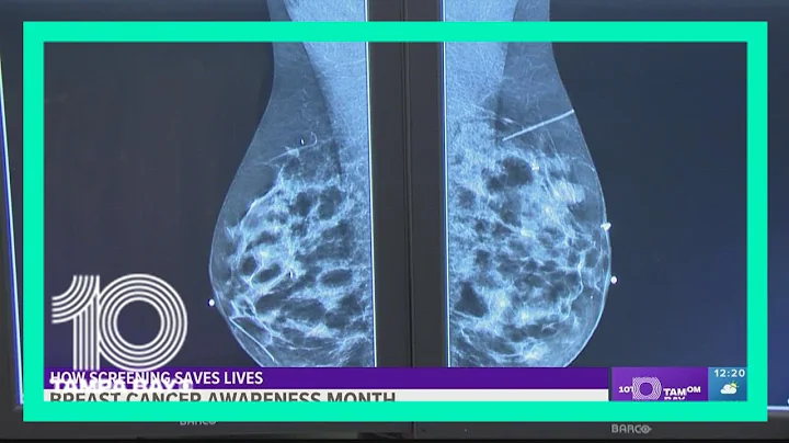 Breast Cancer Awareness Month: How screenings save lives