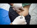 ازاى تدى حقنة لبنك فى البيت بدون اخطاء _ Intramuscular injection for a at home
