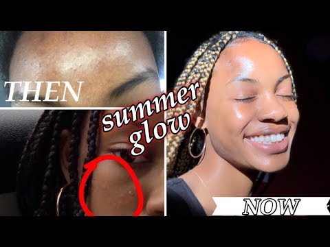 COMO CHEGAR CLEAR SKIN * a verdade *