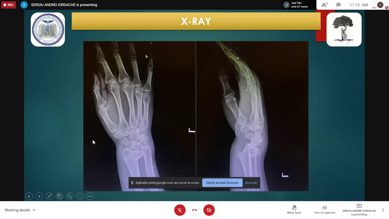 Ortho - Musculoskeletal Imagistics