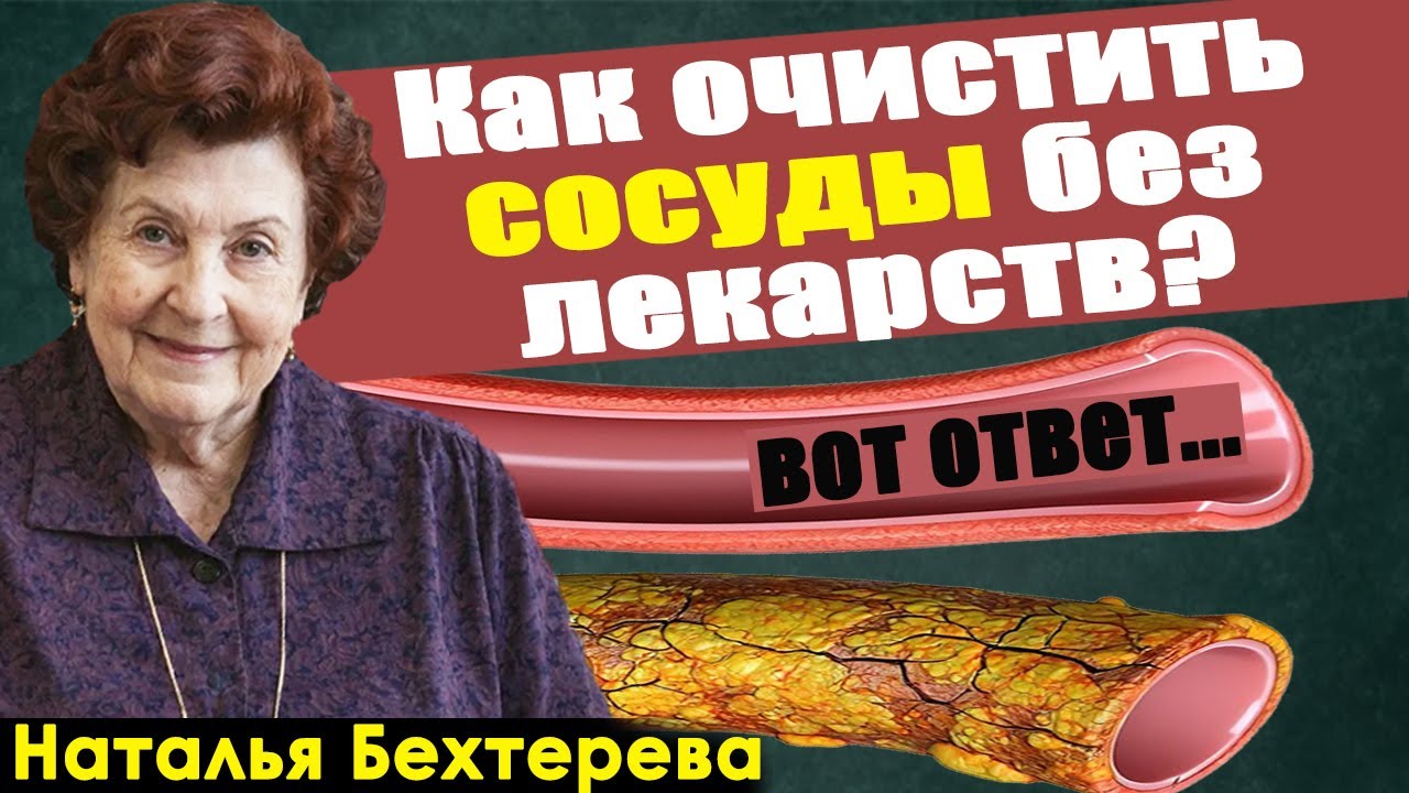 Вся правда о "чистке" сосудов: Как очистить сосуды без лекарств? Простой метод от Бехтеревой