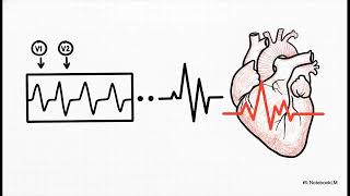 Don’t Miss These MIs: Right Ventricular & Posterior MI Explained (ECG Made Easy)