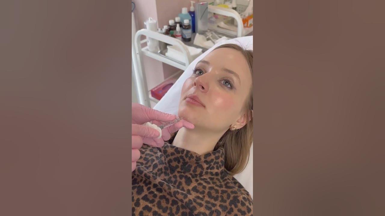 Бажаєте позбутися ямочки на підборідді? - YouTube