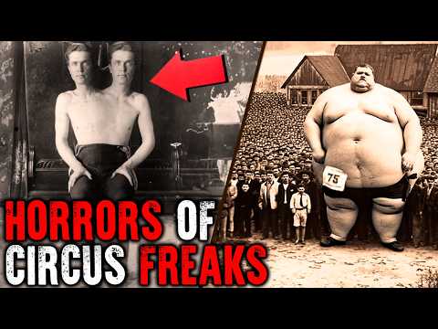Circus Freaks That Actually Existed! Historical Photos - YouTube