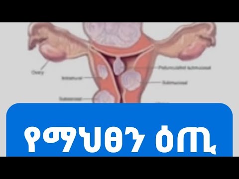 ቪዲዮ: ማሕፀን ከየት ነው የሚመጣው?