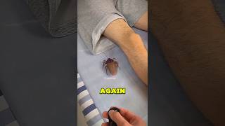 A Roach Got Into My Pants And This Happened ??