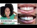 Easy at home teeth whitening  giveaway  smile brilliant