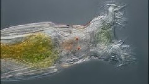 bdelloid rotifer