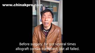 Blind man(corneal injury by lime burn) regains his vision after artificial cornea transplant