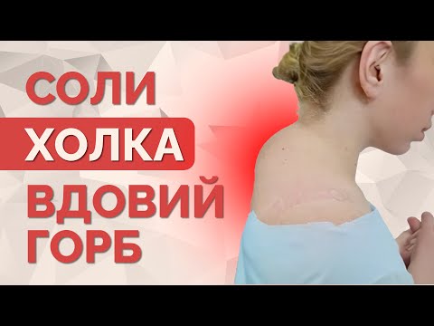 Холка, "вдовий горб", отложение солей? Что же это на самом деле?