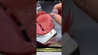 #infodraslanyan #dentist #smiledesigndental