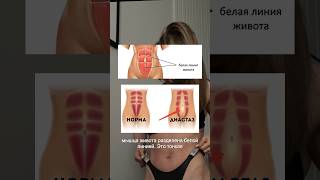 Как определить есть ли диастаз? #спорт #фитнес #тренировка #беременность #дисциплина